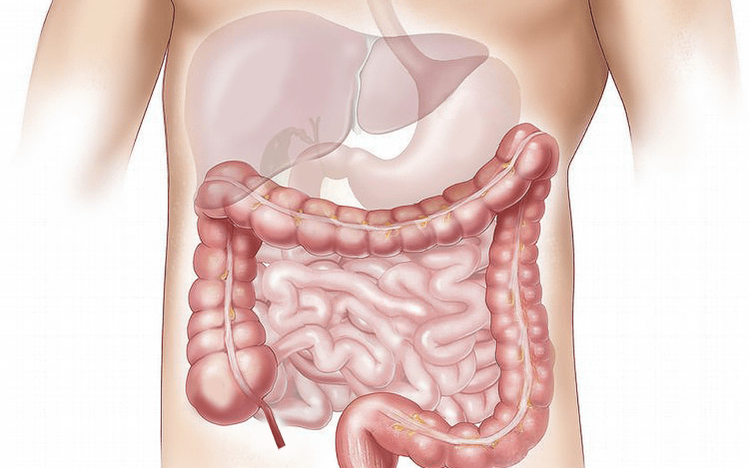 Meta-analysis: no negative effect of moderate alcohol consumption on colorectal cancer survival
