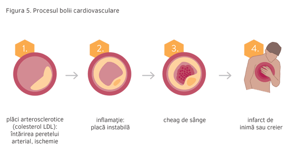 Figura 5. Procesul bolii cardiovasculare
